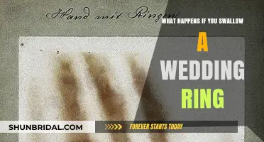 Swallowed Wedding Ring: What to Expect and Do