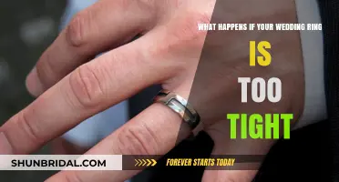 Wedding Ring Too Tight? Here's What to Do