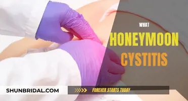 Honeymoon Cystitis: Understanding the Newlywed Bladder Woes