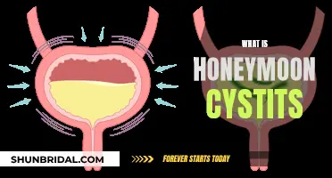 Honeymoon Cystitis: Understanding the Mystery Behind Post-Wedding UTI