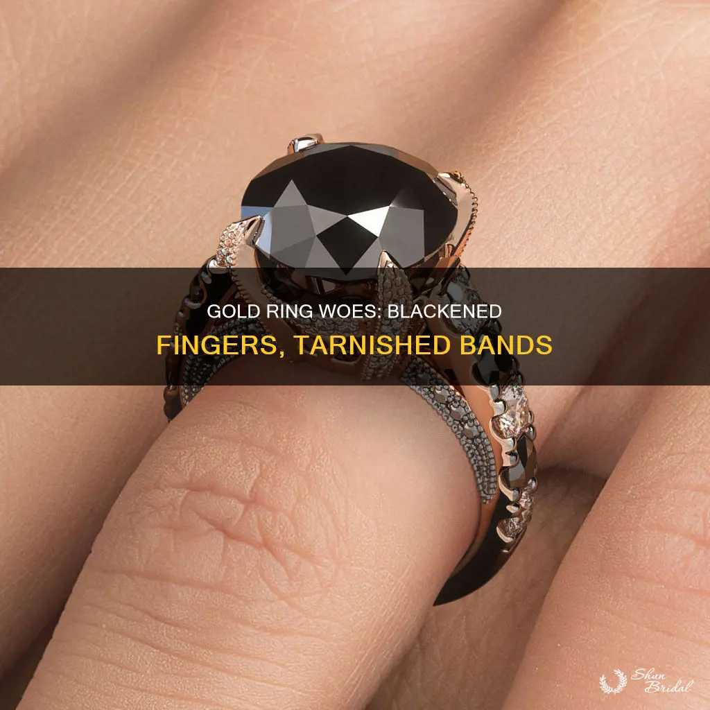 what makes gold wedding ring bands turn fingers black