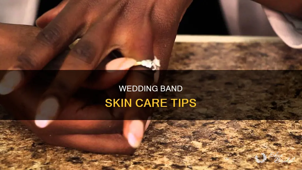 what to do for dry skin under wedding band