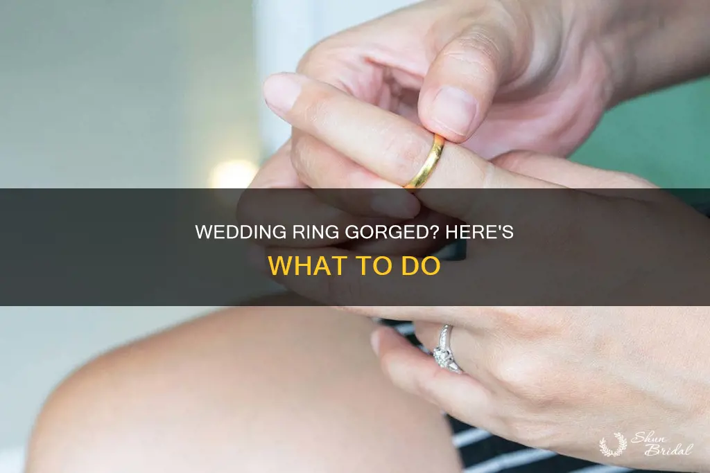 what to do if your wedding ring is gorged