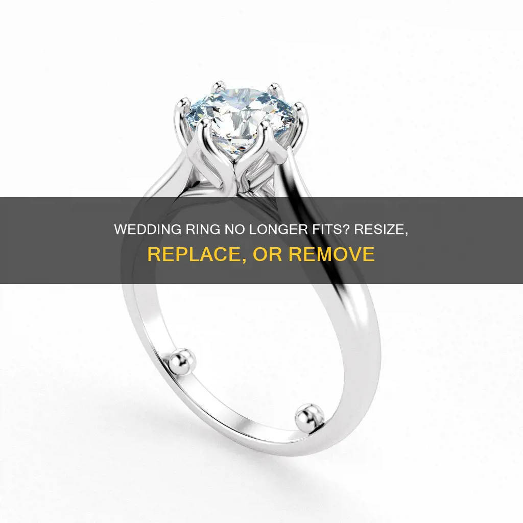what to do when your wedding ring doesn