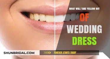 How to Remove Yellow Stains from Your Wedding Dress