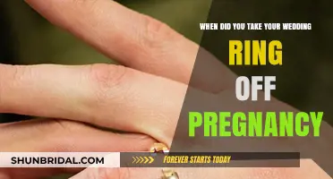Pregnancy and Rings: When to Take Them Off