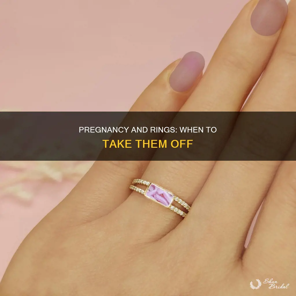 when did you take your wedding ring off pregnancy
