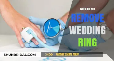 The Wedding Ring: When to Take It Off