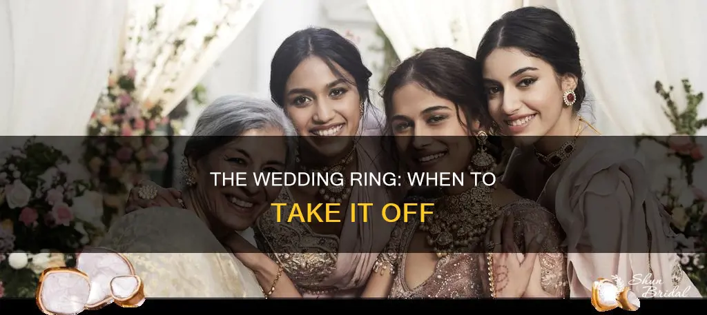 when do you remove wedding ring