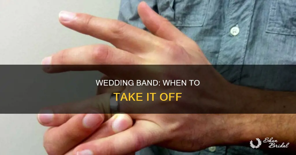 when do you take off your wedding band