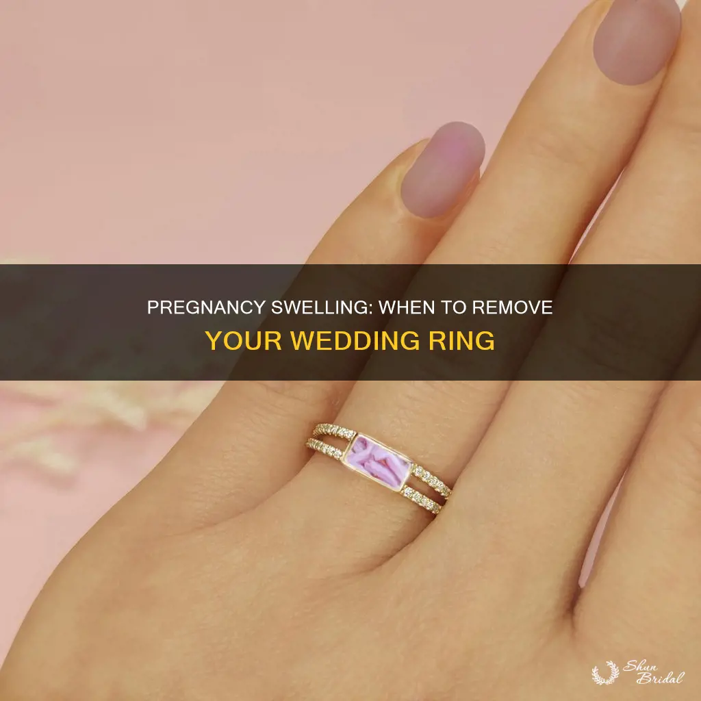 when should I take my wedding ring off during pregnancy