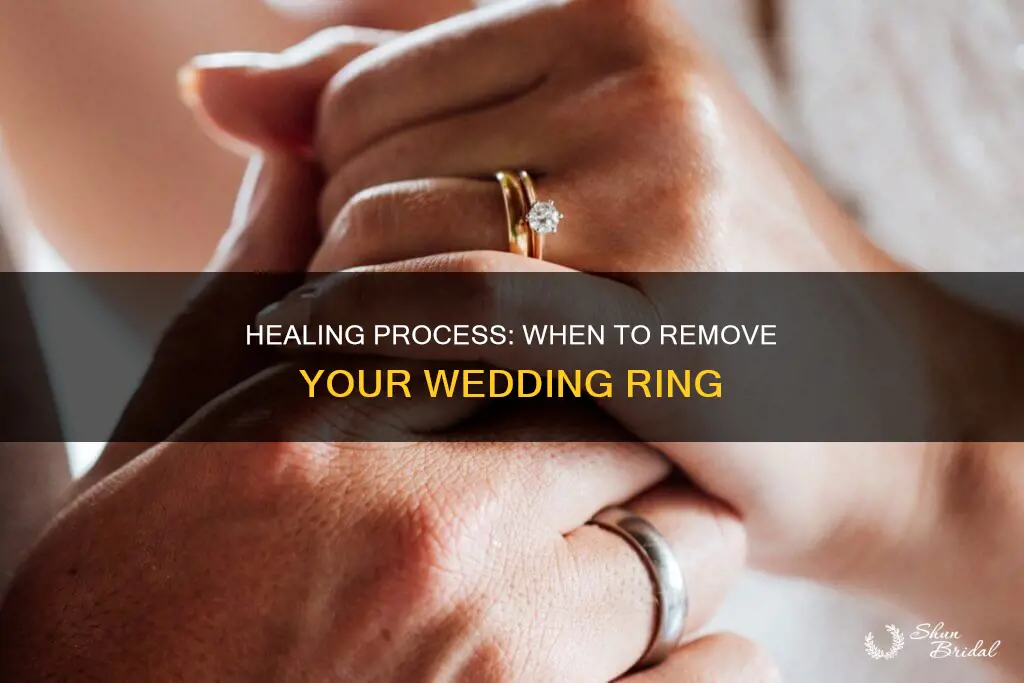 when to remove wedding ring after death of spouse