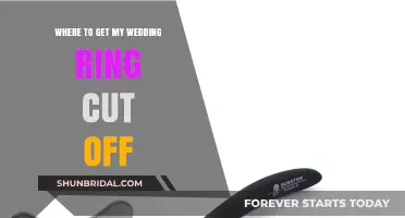 Ring Removal: Wedding Band Cut Off