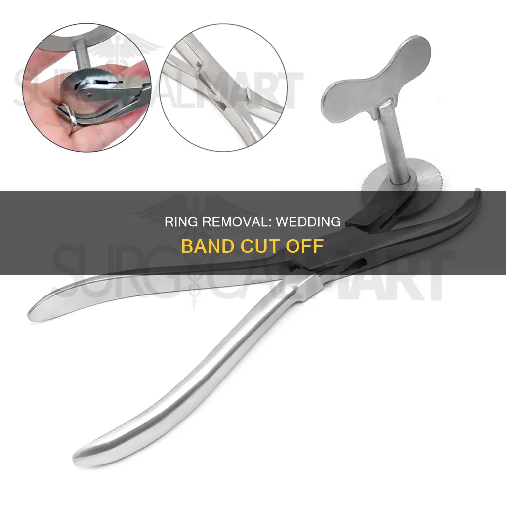 where to get my wedding ring cut off