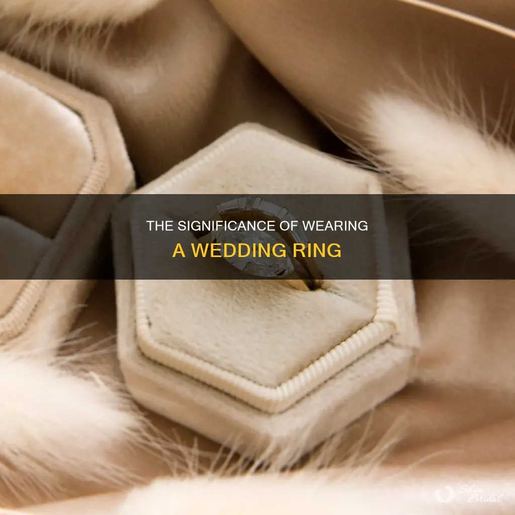 which way should a wedding ring be worn