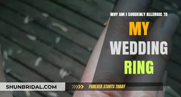 Wedding Ring Allergies: Why the Sudden Reaction?