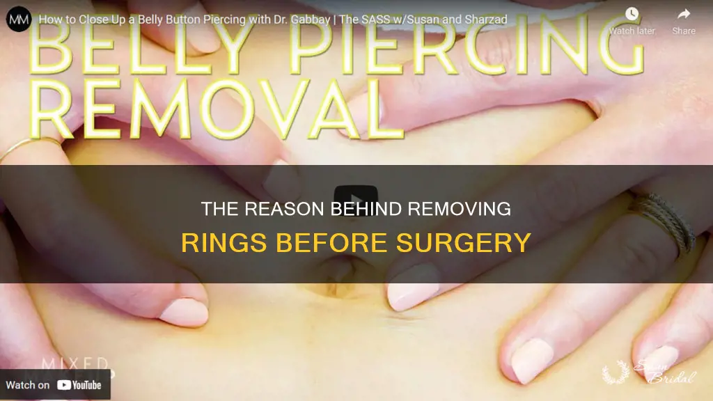 why do remove wedding ring before surgery