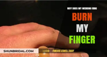 Wedding Ring Burning Finger: What's the Cause?