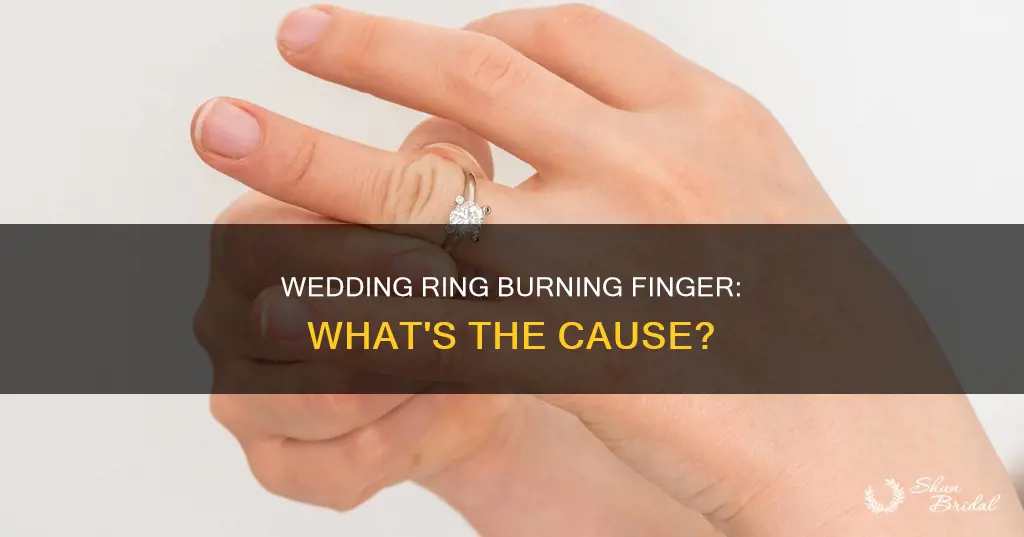 why does my wedding ring burn my finger