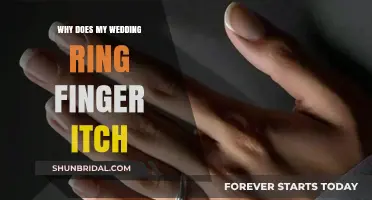 Wedding Ring Finger Itch: What Does It Mean?