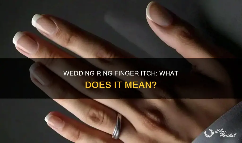why does my wedding ring finger itch