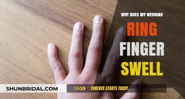Wedding Ring Finger Swelling: Why It Happens