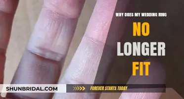 Wedding Ring No Longer Fits: What's Changed?