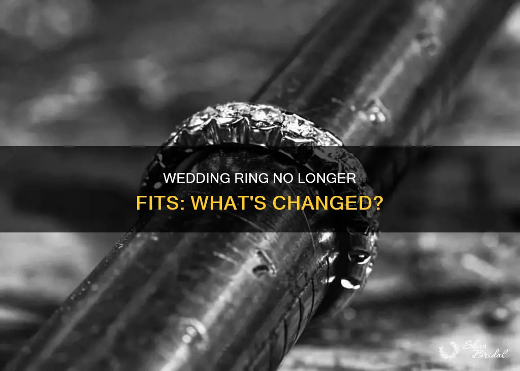 why does my wedding ring no longer fit