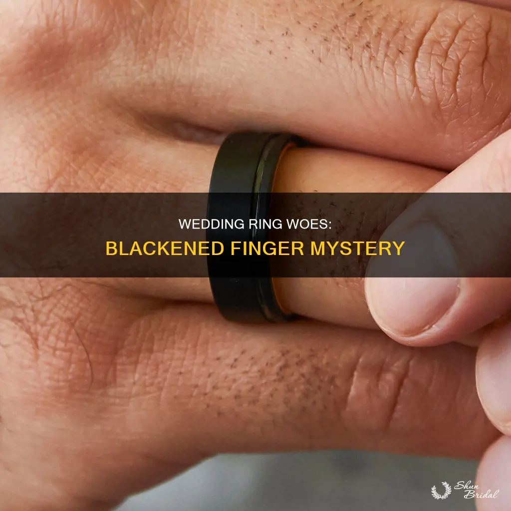 why does my wedding ring turn my finger black