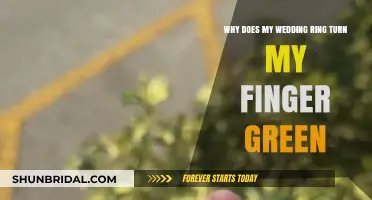 Wedding Ring Woes: Green Finger Mystery