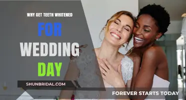 Radiant Wedding Smile: Why Teeth Whitening is Your Perfect Bridal Glow-Up