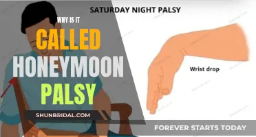 Honeymoon Palsy: A Sweet but Painful Nuptial Tradition Explained