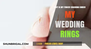 Wedding Ring Finger Cracking: What's the Cause?