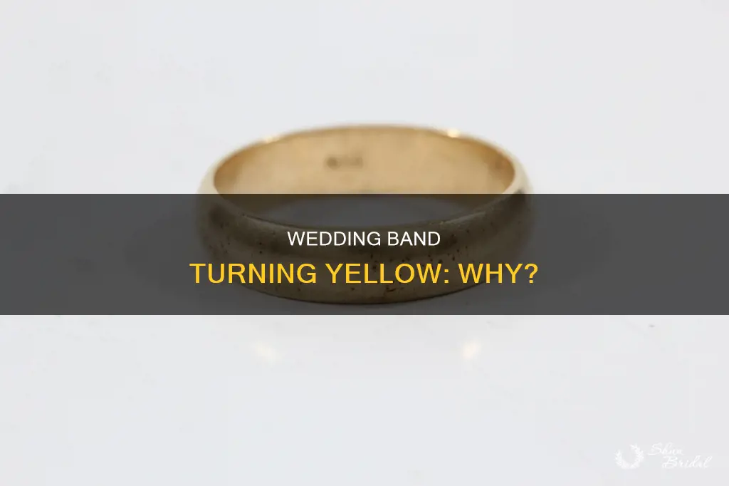 why is my wedding band turning yellow