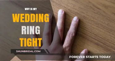 Wedding Ring Feeling Tight? Here's Why
