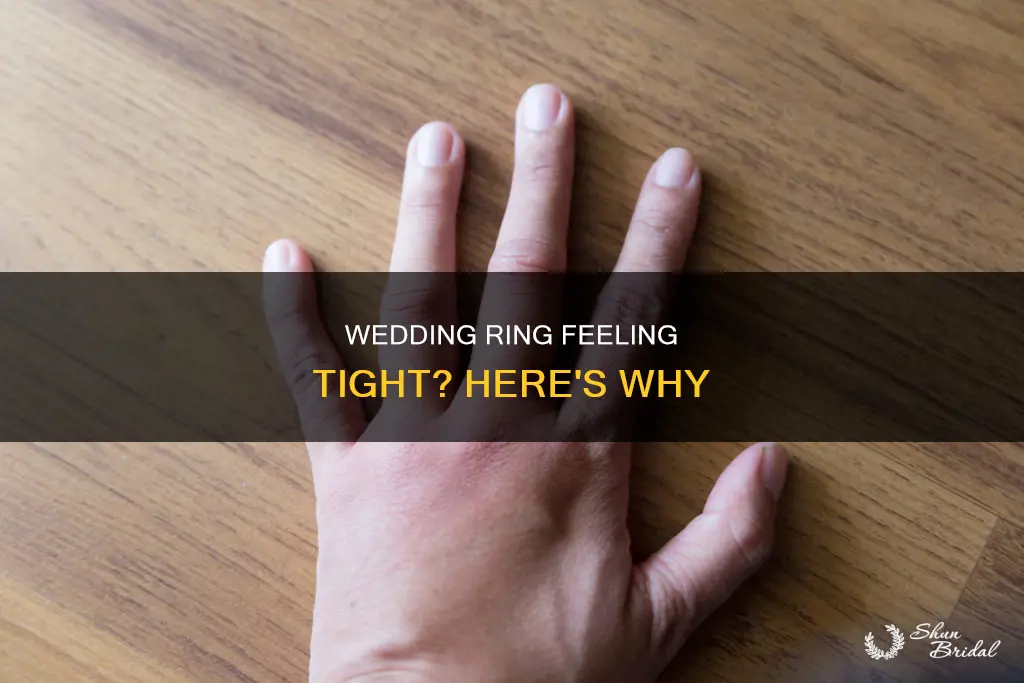 why is my wedding ring tight