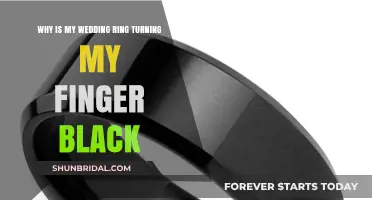 Wedding Ring Woes: Black Finger Blues