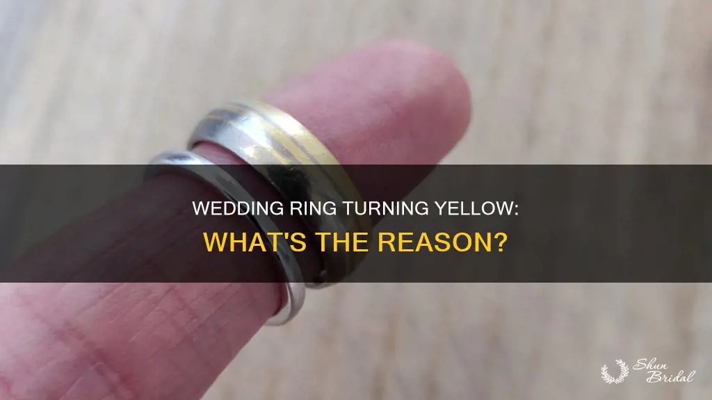 why is my wedding ring turning yellow