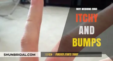 Wedding Ring Itch: Understanding the Bumps and Irritation