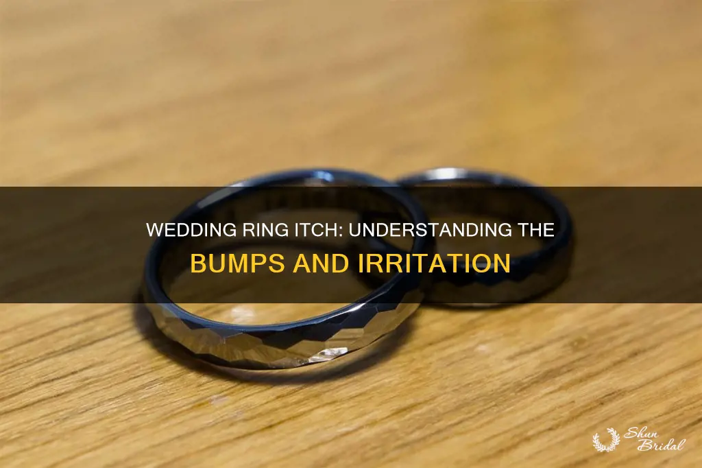 why wedding ring itchy and bumps