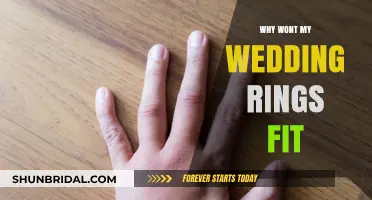 Wedding Rings: Why Won't They Fit?