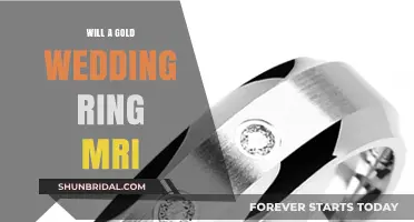 Gold Wedding Rings: MRI Safe?