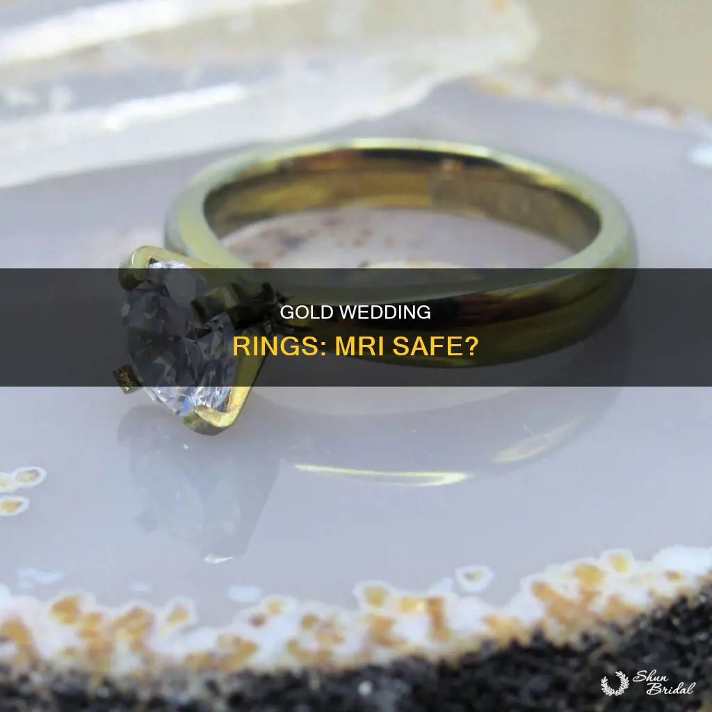 will a gold wedding ring mri