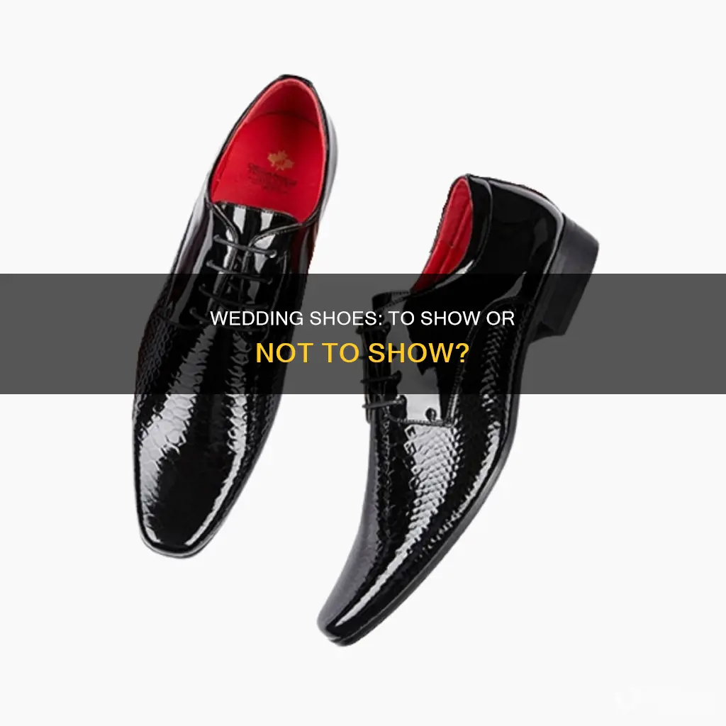 will anyone see my wedding shoes