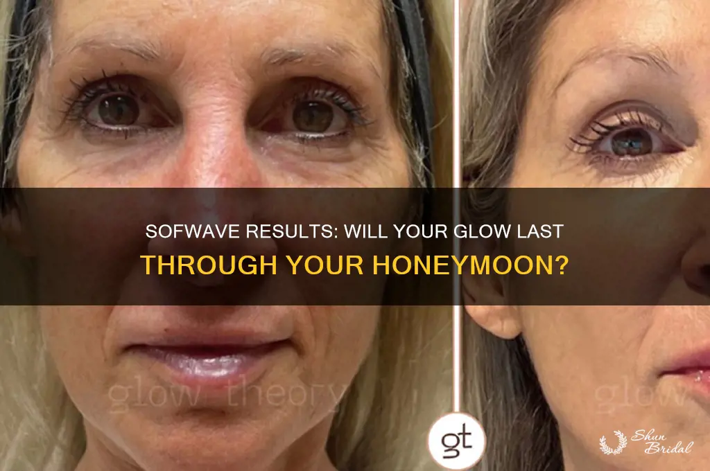 will sofwave results last through a honeymoon